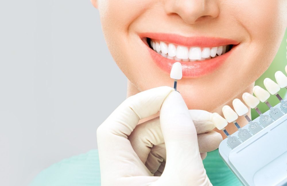 Close up portrait of Young women in dentist chair, Check and select the color of the teeth. Dentist makes the process of treatment in dental clinic office. Teeth whitenning.